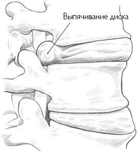 Йога-терапия. Руководство по укреплению мышц, борьбе с болью и последствиями травм - i_013.jpg