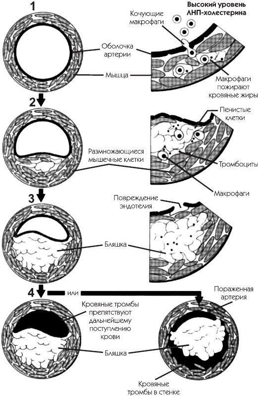 Атеросклероз. Советы кардиолога, которые спасут вам жизнь - i_001.jpg