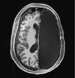 Живой мозг. Удивительные факты о нейропластичности и возможностях мозга - i_001.jpg