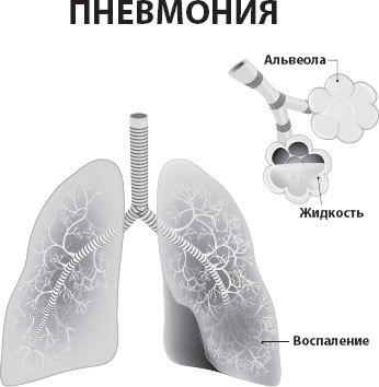 Медицина для умных. Современные аспекты доказательной медицины для думающих пациентов - i_014.jpg