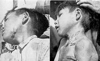 Питание и физическая дегенерация - _16.jpg