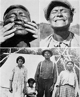 Питание и физическая дегенерация - _20.jpg