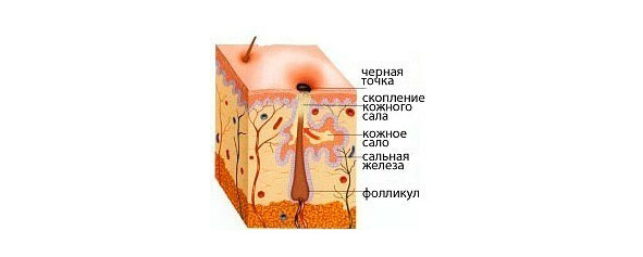 Как избавиться от прыщей и угрей раз и навсегда! Революционный, комплексный подход к устранению акне! - _3.jpg