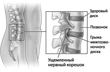 Звучание походки. Методика оздоровления спины и обретения красивой осанки - i_031.jpg