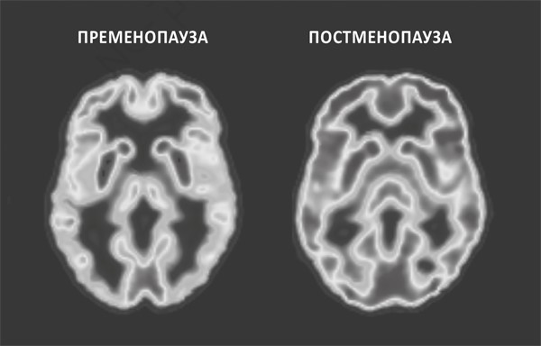 XX-мозг. Новейшие открытия, которые помогут женщинам укрепить когнитивное здоровье, поддерживать гормональный баланс и предупредить болезнь Альцгеймера - i_001.jpg