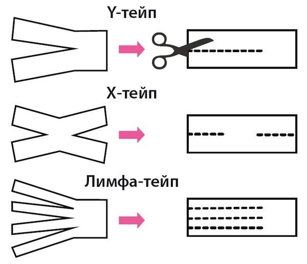 Тейпирование тела. Как избавиться от проблемных зон без спорта и диет - i_009.jpg