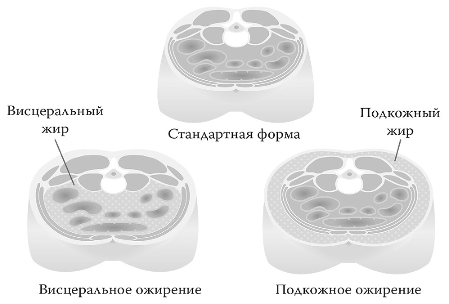 Базовый ЗОЖ. Сахар, жир и фитнес-тренды - i_056.jpg