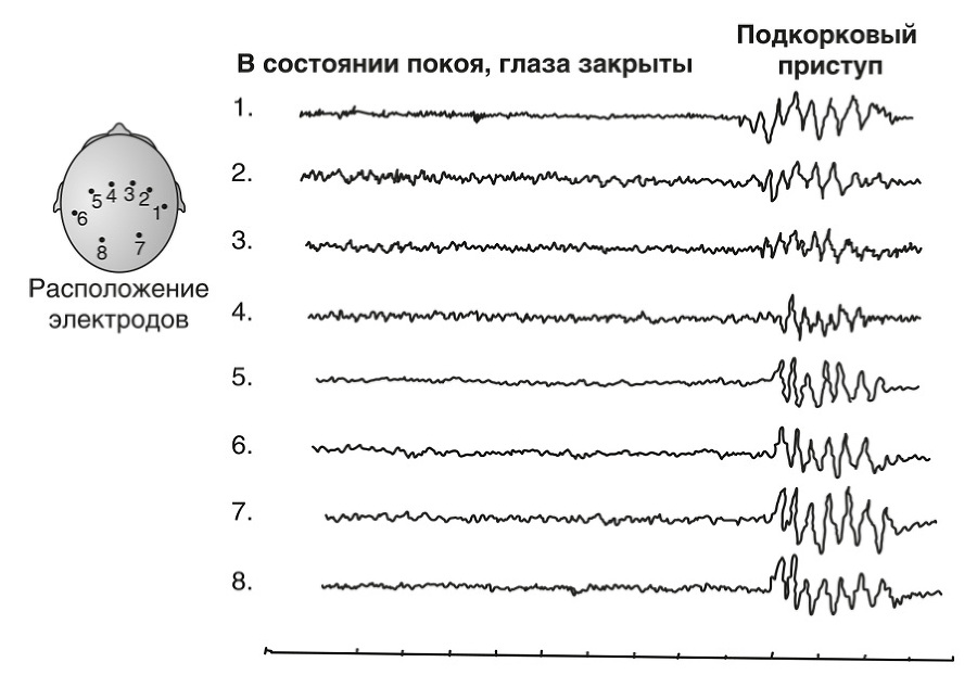 Запутанный мозг. Путеводитель по нейропсихологии - i_009.jpg