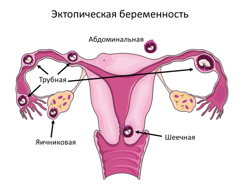 Homo sapiens под микроскопом - i_039.png