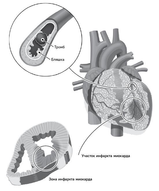 Достучаться до сердца. Советы кардиолога, которые спасут жизнь - i_005.jpg