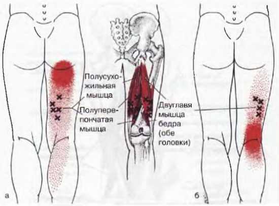 Миофасциальные боли и дисфункции. Руководство по триггерным точкам (в 2-х томах). Том 2. Нижние конечности - _00.jpg_17