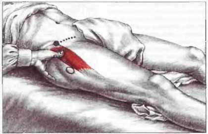 Миофасциальные боли и дисфункции. Руководство по триггерным точкам (в 2-х томах). Том 2. Нижние конечности - _02.jpg_10