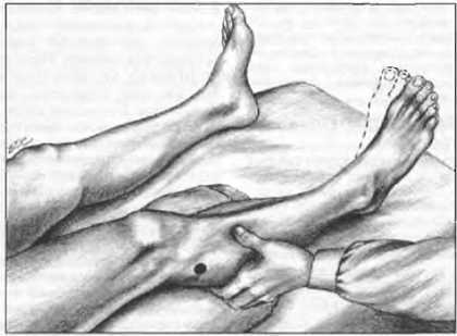 Миофасциальные боли и дисфункции. Руководство по триггерным точкам (в 2-х томах). Том 2. Нижние конечности - _02.jpg_17