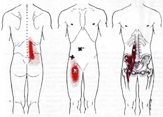 Миофасциальные боли и дисфункции. Руководство по триггерным точкам (в 2-х томах). Том 2. Нижние конечности - _02.jpg_2