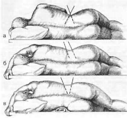 Миофасциальные боли и дисфункции. Руководство по триггерным точкам (в 2-х томах). Том 2. Нижние конечности - _03.jpg_1