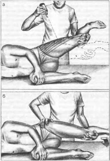 Миофасциальные боли и дисфункции. Руководство по триггерным точкам (в 2-х томах). Том 2. Нижние конечности - _03.jpg_10