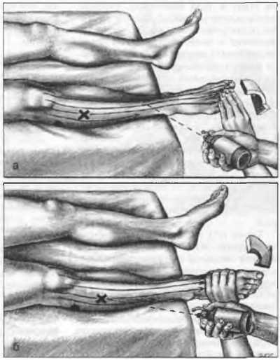 Миофасциальные боли и дисфункции. Руководство по триггерным точкам (в 2-х томах). Том 2. Нижние конечности - _03.jpg_17