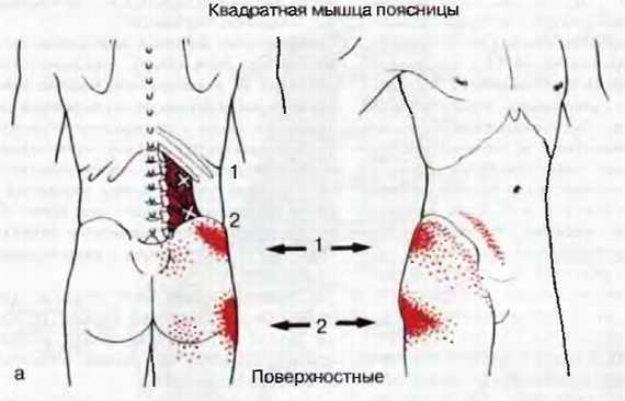 Миофасциальные боли и дисфункции. Руководство по триггерным точкам (в 2-х томах). Том 2. Нижние конечности - _04.jpg