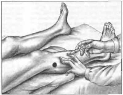 Миофасциальные боли и дисфункции. Руководство по триггерным точкам (в 2-х томах). Том 2. Нижние конечности - _04.jpg_15