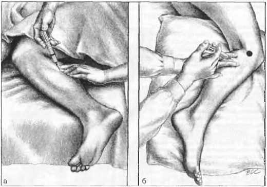 Миофасциальные боли и дисфункции. Руководство по триггерным точкам (в 2-х томах). Том 2. Нижние конечности - _04.jpg_17