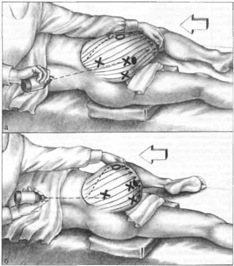 Миофасциальные боли и дисфункции. Руководство по триггерным точкам (в 2-х томах). Том 2. Нижние конечности - _04.jpg_3