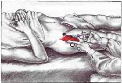 Миофасциальные боли и дисфункции. Руководство по триггерным точкам (в 2-х томах). Том 2. Нижние конечности - _04.jpg_8