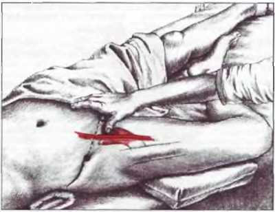 Миофасциальные боли и дисфункции. Руководство по триггерным точкам (в 2-х томах). Том 2. Нижние конечности - _04.jpg_9