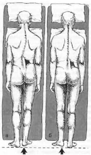 Миофасциальные боли и дисфункции. Руководство по триггерным точкам (в 2-х томах). Том 2. Нижние конечности - _05.jpg_0