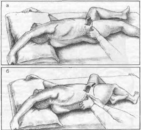 Миофасциальные боли и дисфункции. Руководство по триггерным точкам (в 2-х томах). Том 2. Нижние конечности - _05.jpg_1