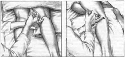 Миофасциальные боли и дисфункции. Руководство по триггерным точкам (в 2-х томах). Том 2. Нижние конечности - _05.jpg_16