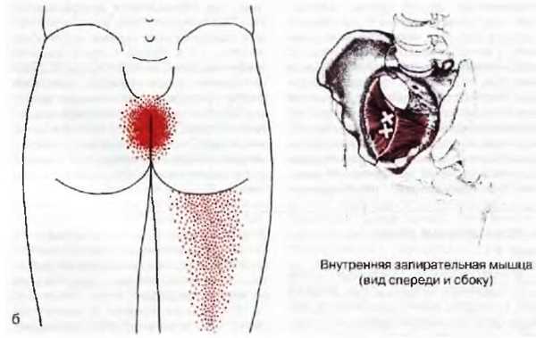 Миофасциальные боли и дисфункции. Руководство по триггерным точкам (в 2-х томах). Том 2. Нижние конечности - _05.jpg_2