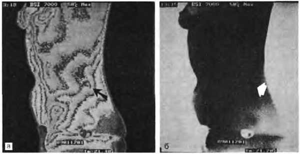 Миофасциальные боли и дисфункции. Руководство по триггерным точкам (в 2-х томах). Том 2. Нижние конечности - _06.jpg_0