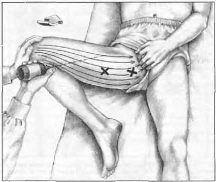 Миофасциальные боли и дисфункции. Руководство по триггерным точкам (в 2-х томах). Том 2. Нижние конечности - _06.jpg_10