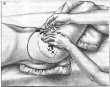 Миофасциальные боли и дисфункции. Руководство по триггерным точкам (в 2-х томах). Том 2. Нижние конечности - _06.jpg_5