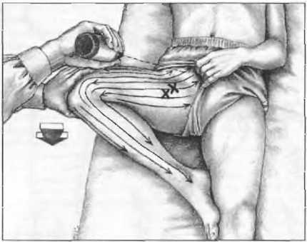 Миофасциальные боли и дисфункции. Руководство по триггерным точкам (в 2-х томах). Том 2. Нижние конечности - _07.jpg_10
