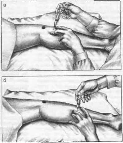 Миофасциальные боли и дисфункции. Руководство по триггерным точкам (в 2-х томах). Том 2. Нижние конечности - _07.jpg_13