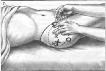 Миофасциальные боли и дисфункции. Руководство по триггерным точкам (в 2-х томах). Том 2. Нижние конечности - _07.jpg_5