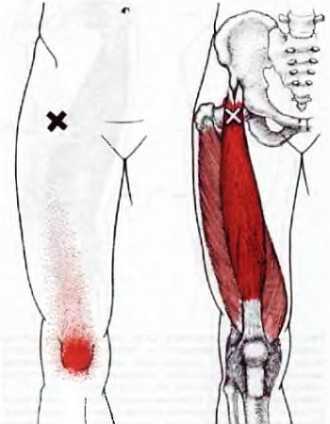 Миофасциальные боли и дисфункции. Руководство по триггерным точкам (в 2-х томах). Том 2. Нижние конечности - _07.jpg_6