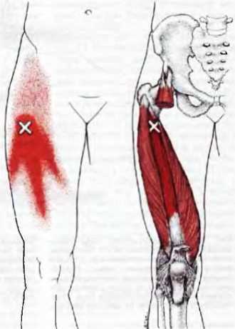 Миофасциальные боли и дисфункции. Руководство по триггерным точкам (в 2-х томах). Том 2. Нижние конечности - _09.jpg_3