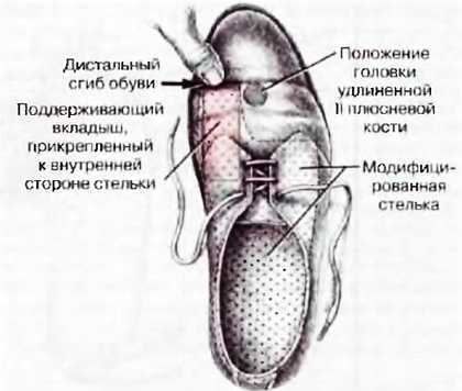 Миофасциальные боли и дисфункции. Руководство по триггерным точкам (в 2-х томах). Том 2. Нижние конечности - _09.jpg_6