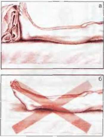 Миофасциальные боли и дисфункции. Руководство по триггерным точкам (в 2-х томах). Том 2. Нижние конечности - _09.jpg_7