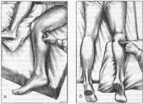 Миофасциальные боли и дисфункции. Руководство по триггерным точкам (в 2-х томах). Том 2. Нижние конечности - _00.jpg_23