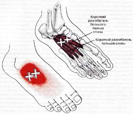 Миофасциальные боли и дисфункции. Руководство по триггерным точкам (в 2-х томах). Том 2. Нижние конечности - _00.jpg_24