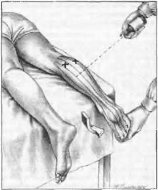 Миофасциальные боли и дисфункции. Руководство по триггерным точкам (в 2-х томах). Том 2. Нижние конечности - _01.jpg_22