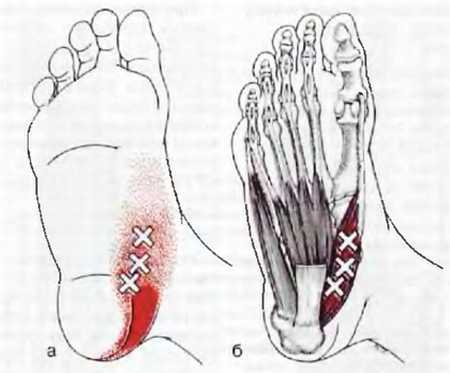 Миофасциальные боли и дисфункции. Руководство по триггерным точкам (в 2-х томах). Том 2. Нижние конечности - _01.jpg_23