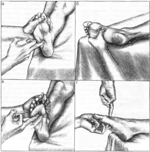 Миофасциальные боли и дисфункции. Руководство по триггерным точкам (в 2-х томах). Том 2. Нижние конечности - _02.jpg_23