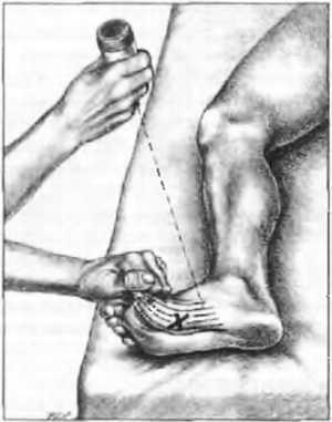 Миофасциальные боли и дисфункции. Руководство по триггерным точкам (в 2-х томах). Том 2. Нижние конечности - _03.jpg_23