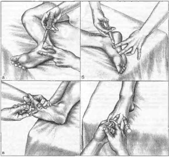 Миофасциальные боли и дисфункции. Руководство по триггерным точкам (в 2-х томах). Том 2. Нижние конечности - _04.jpg_21
