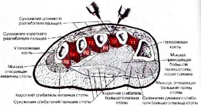 Миофасциальные боли и дисфункции. Руководство по триггерным точкам (в 2-х томах). Том 2. Нижние конечности - _05.jpg_20