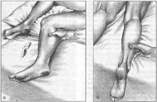 Миофасциальные боли и дисфункции. Руководство по триггерным точкам (в 2-х томах). Том 2. Нижние конечности - _10.jpg_9